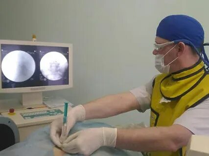 Денервация коленного сустава отзывы