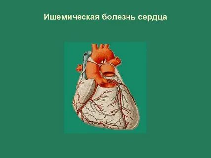 Ишемические поражения сердца
