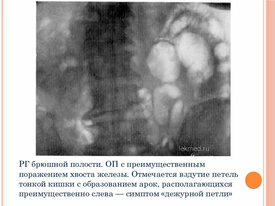 Шум над почечной артерией. Шум над сонной артерией. Преимущественно слева. Методы исследования позвоночника. Инструкция по охране труда при работе на персональном компьютере.