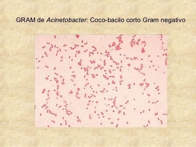 Acinetobacter spp. Acinetobacter spp. Acinetobacter spp. Acinetobacter baumannii антибиотики. Ацинетобактер баумании биохимические свойства.