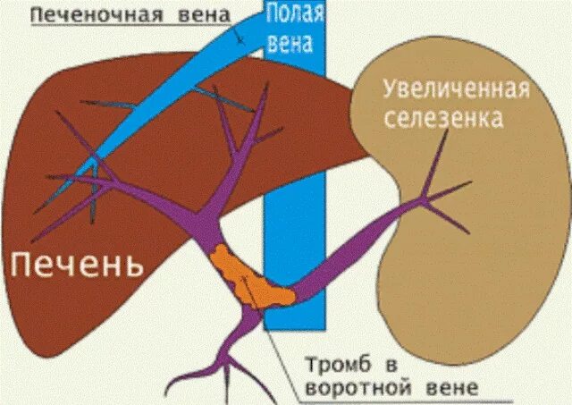 Печень портальный