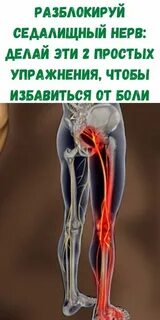 Почему защемления седалищного нерва