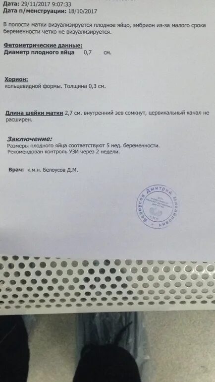 Плодное яйцо видно при хгч