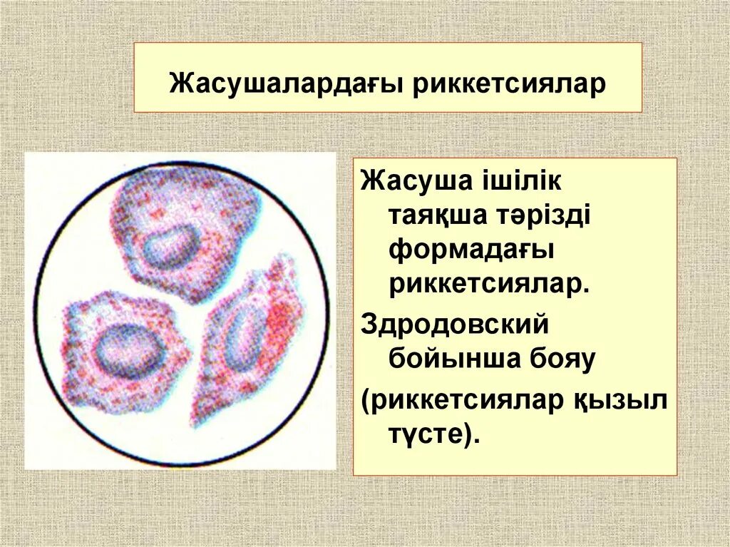 Тип дыхания риккетсий. Окраска риккетсий по здродовскому. окрашивание по здродовскому микробиология. риккетсии микробиология. риккетсиозы микробиология.