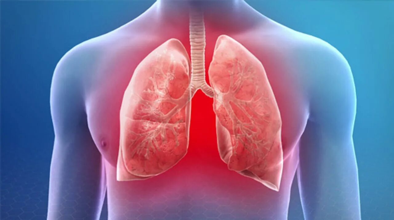 Пульмонология легкие. Злокачественная опухоль. Легкие эксперты. Легкие эксперты. Рмдиолооич обследование легких.