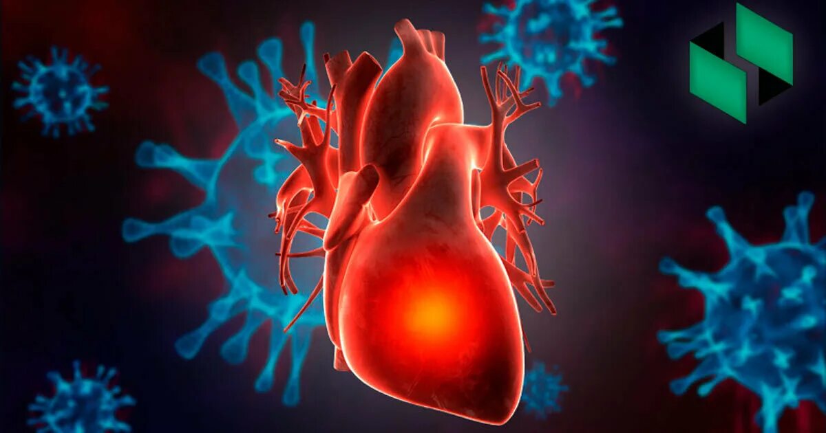 Covid 19 disease. Поражение сердечно-сосудистой системы. Сердце после коронавируса. Поражение коронавируса