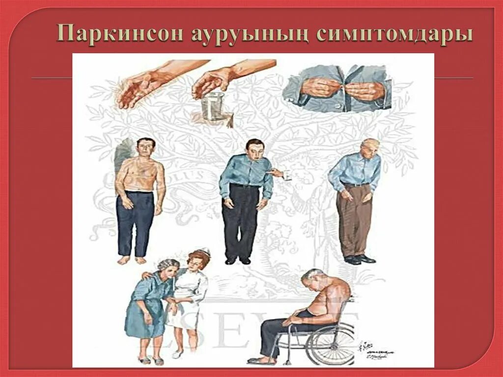 Этиология и патогенез болезни паркинсона. Болезнь паркинсона фото. Помощь родственникам с болезнью паркинсона. Болезнь паркинсона. Пациент с болезнью паркинсона.