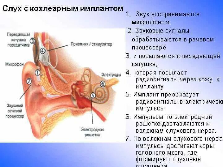 Список заболеваний среднего уха. Поражение среднего уха. Симптомы заболевания среднего уха. Заболевания среднего уха перечислить.