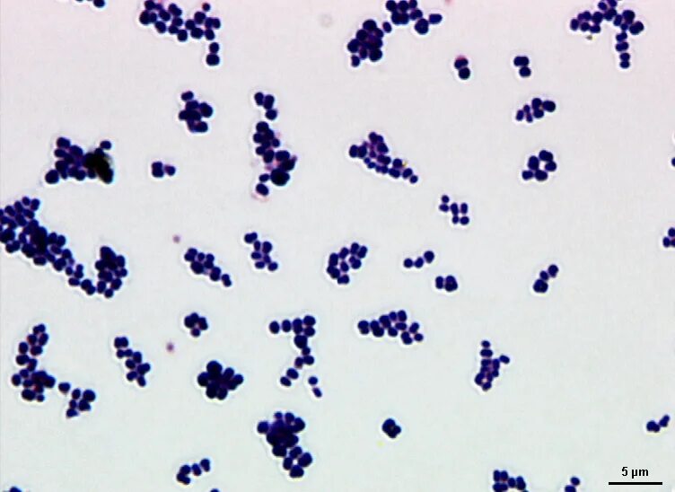 Pediococcus Damnosus. Пробиотик Leuconostoc mesenteroides. Молочнокислые педиококки. Лейконосток бактерия. Rothia mucilaginosa