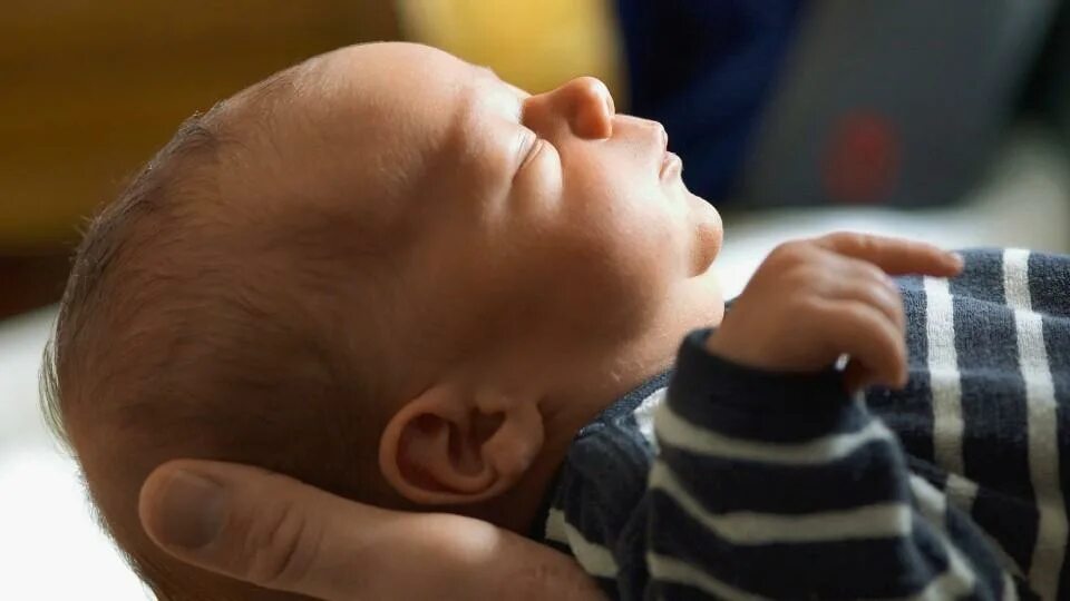 Роднички у недоношенных детей. Роднички у недоношенного новорожденного. Голова новорожденных малышей. Большой Родничок у недоношенных детей.