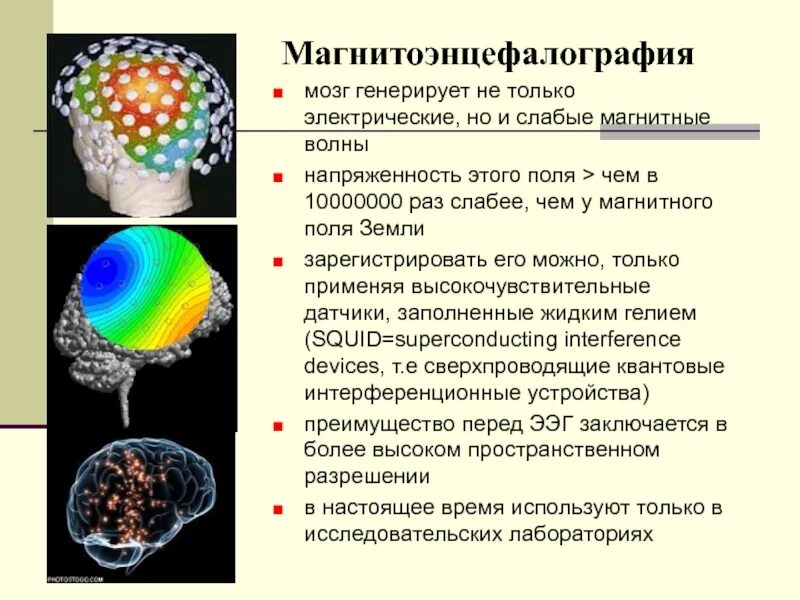 Как понять генерирует. Магнитоэнцефалография сущность метода. Дэвид Коэн магнитоэнцефалография. Электроэнцефалография и магнитоэнцефалография. Магнитоэнцефалография (Мэг).