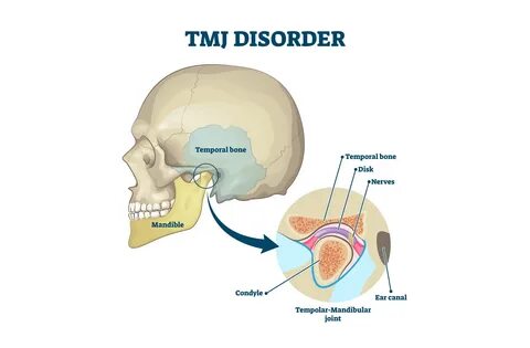 How Do Dentists Find Out if You Have TMJ? 
