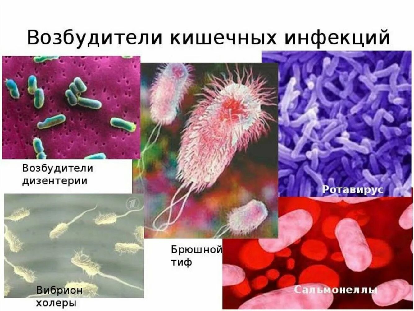 Острые кишечные инфекции бактерии возбудители. Микробы возбудители инфекционных заболеваний. Возбудители вирусных кишечных инфекций. Возбудители бактериальных кишечных инфекции вибрион микробиология. Возбудители инфекционных заболеваний это