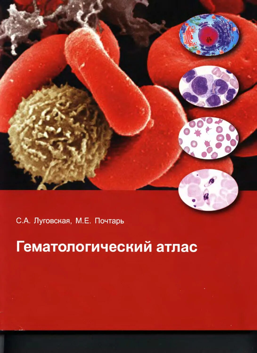 Гематологический атлас луговская. Клиническая лабораторная гематология. Клиническая лабораторная гематология. Клиническая лабораторная гематология. Клиническая лабораторная гематология.