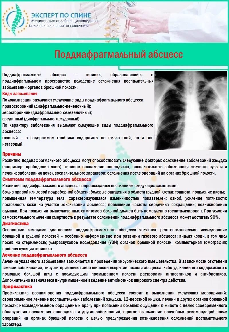 Почему немеет живот. Поддиафрагмальный абсцесс. Причины поддиафрагмального абсцесса. Диагностика поддиафрагмального абсцесса. Поддиафрагмальный абсцесс клинические рекомендации.