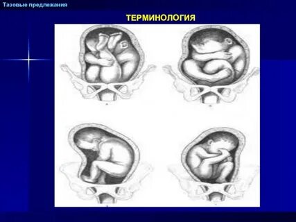 Предлежания плечика