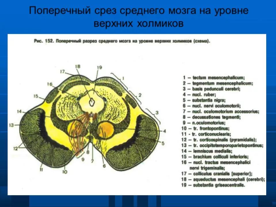 Данные поперечного среза. Поперечный разрез среднего мозга на уровне верхних холмиков. Строение среднего мозга на поперечном срезе. Срез среднего мозга на уровне нижних холмиков четверохолмия.. Строение среднего мозга поперечный разрез.