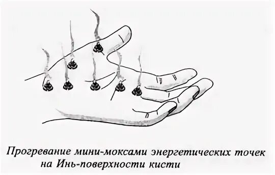 Согревающая точка