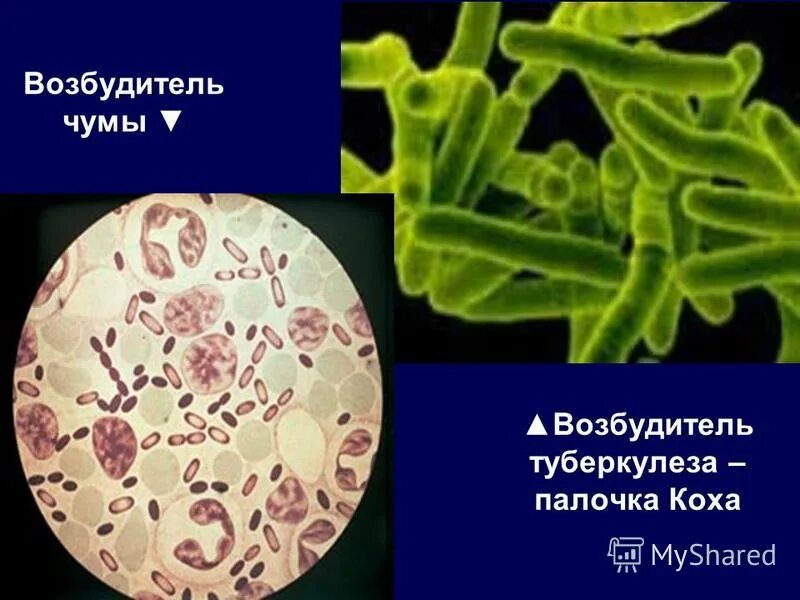 Иммунитет возбудителя чумы