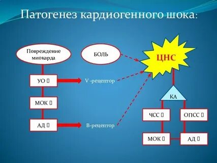 Кардиогенный шок патогенез