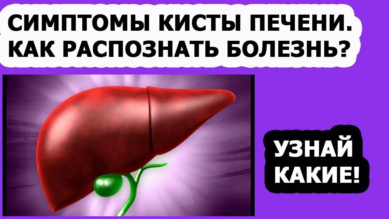 Киста печени причины возникновения у женщин. Киста правой доли печени. Паразитарная киста печени. Непаразитарные кисты печени.