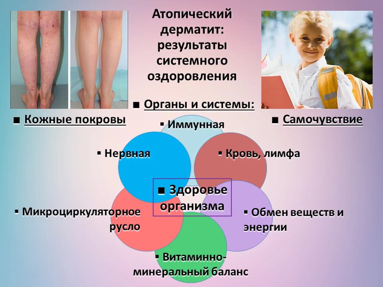 Атопический дерматит психосоматика. Атопический дерматит у взрослых психосоматика. Психосоматика атопического дерматита. Атопический дерматит у взрослых психосоматика причины заболеваний. Сама причина болезни