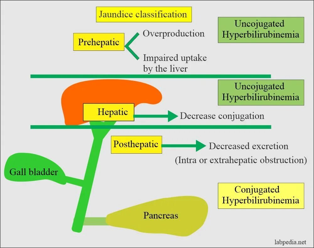 Желтуха заразная или нет. Jaundice classification. Механическая желтуха фон. Холестатическая желтуха.