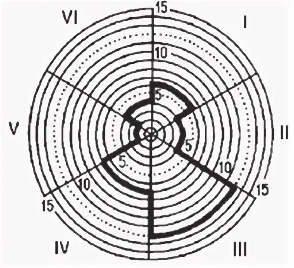 Вишняковой. Тест креативности вишняковой. Тест торренса. Тест "креативность" н. Психодиагностика творческого мышления креативные тесты е туник.
