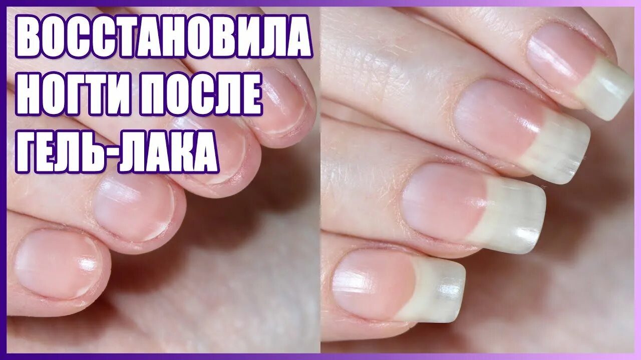 Сняла ногти как их восстановить Pin by Claudia on tecniche unghie Colorful nail designs, Nail courses, Nail tech