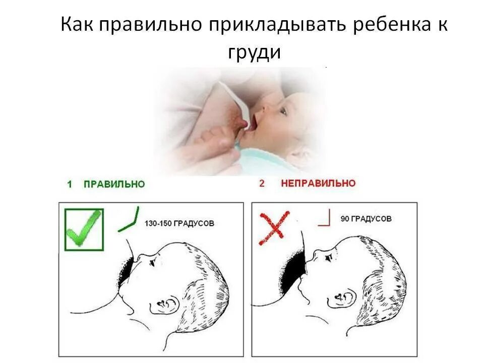 Прикладывание новорожденного ребенка при кормлении к груди. Правильная техника прикладывания ребенка к груди. Правильный захват при кормлении грудничка. Правильно прикладывать новорожденного для кормления к груди.