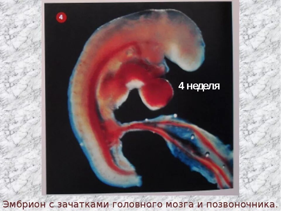 Эмбрион на 4 неделе беременности. Четырех недельный эмбрион. Зародыш на 4 неделе беременности.