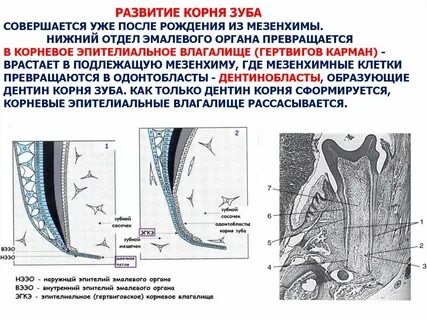 Апикальный упор