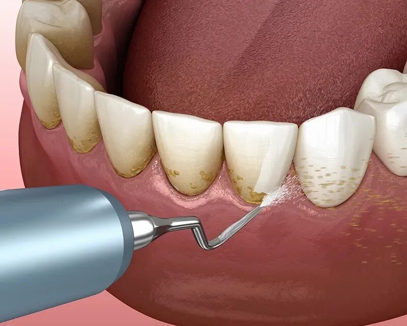 Более 1 300 работ на тему "Front Tooth Pain": стоковые фото, картинки и изображе