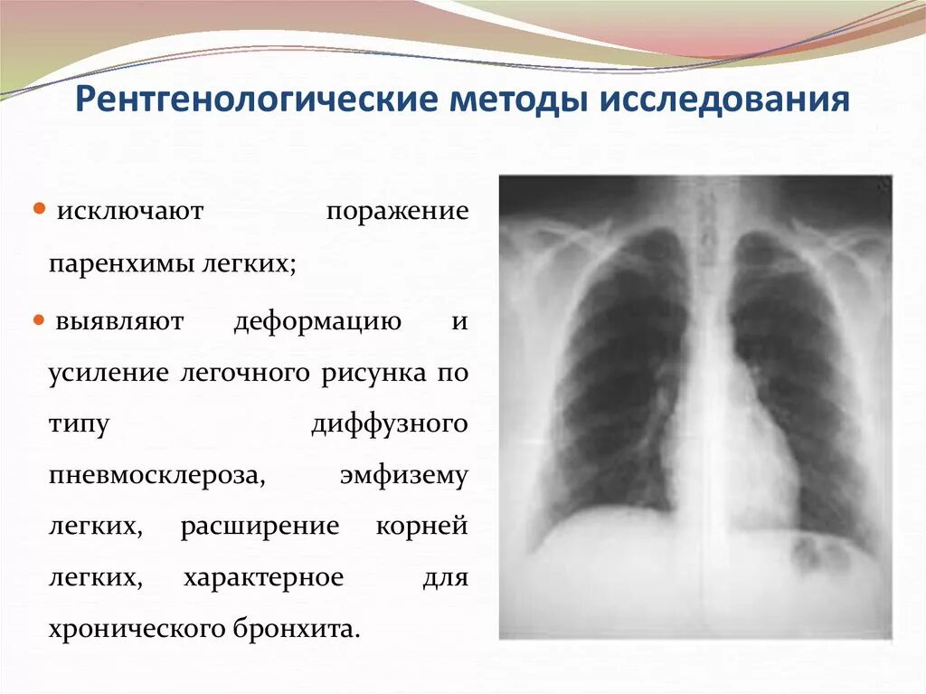 Ячеистая деформация легочного рисунка. Легочный рисунок деформирован. Методы рентгенологического исследования легких. Легочный рисунок усилен деформирован.