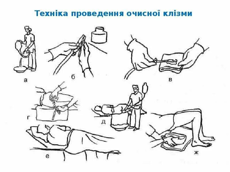 Как поставить человеку клизму