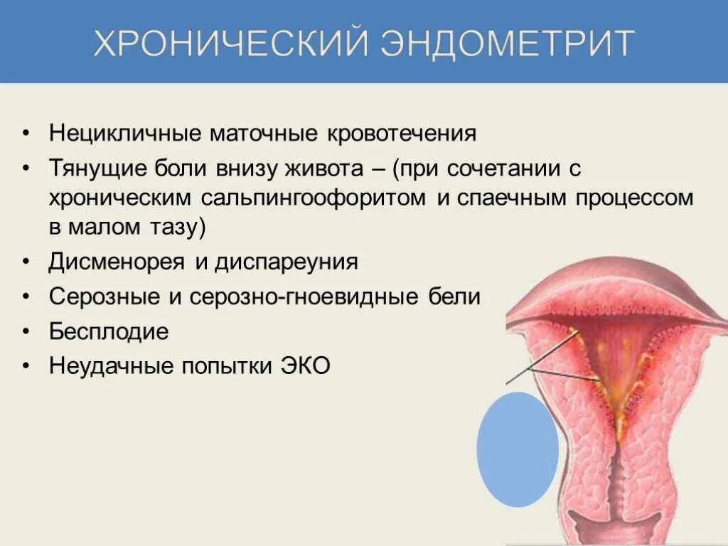 Эндометрит воспаленный. Хронический эндометрит симптомы. Метроэндометрит и эндометрит. Эндометрия можно вылечить