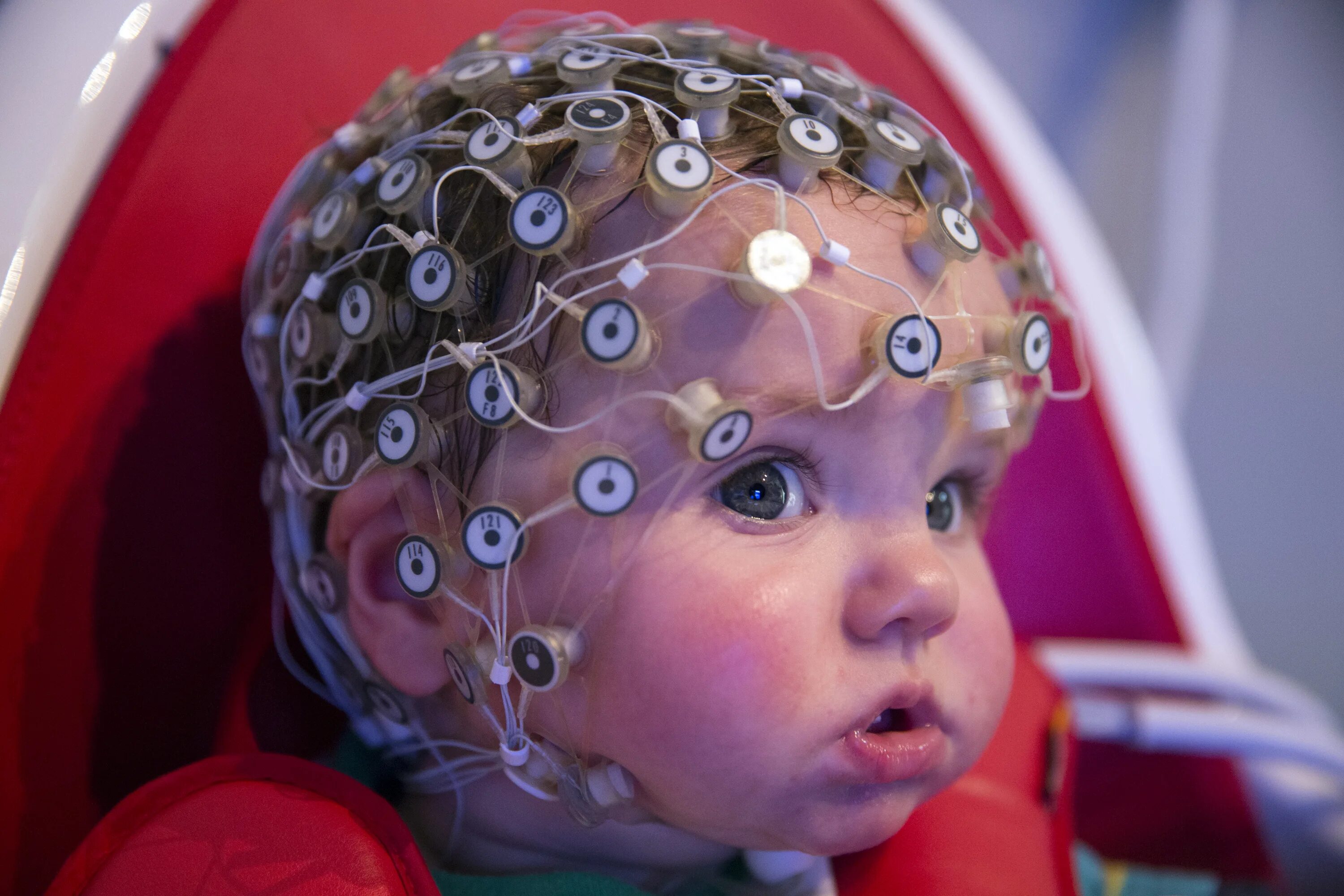 Моцарт детям для мозга. Электроэнцефалография (ЭЭГ). Электроэнцефалография головного мозга (ЭЭГ). ЭЭГ головного мозга ребенку. Микрополяризация ТКМП головного мозга.