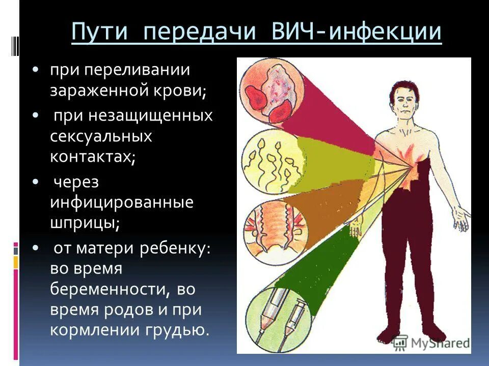 Два способа распространения спид. Основные способы передачи вич. пути заражения вич- инфекцией схема. способы заражения спидом. спид способ распространения.