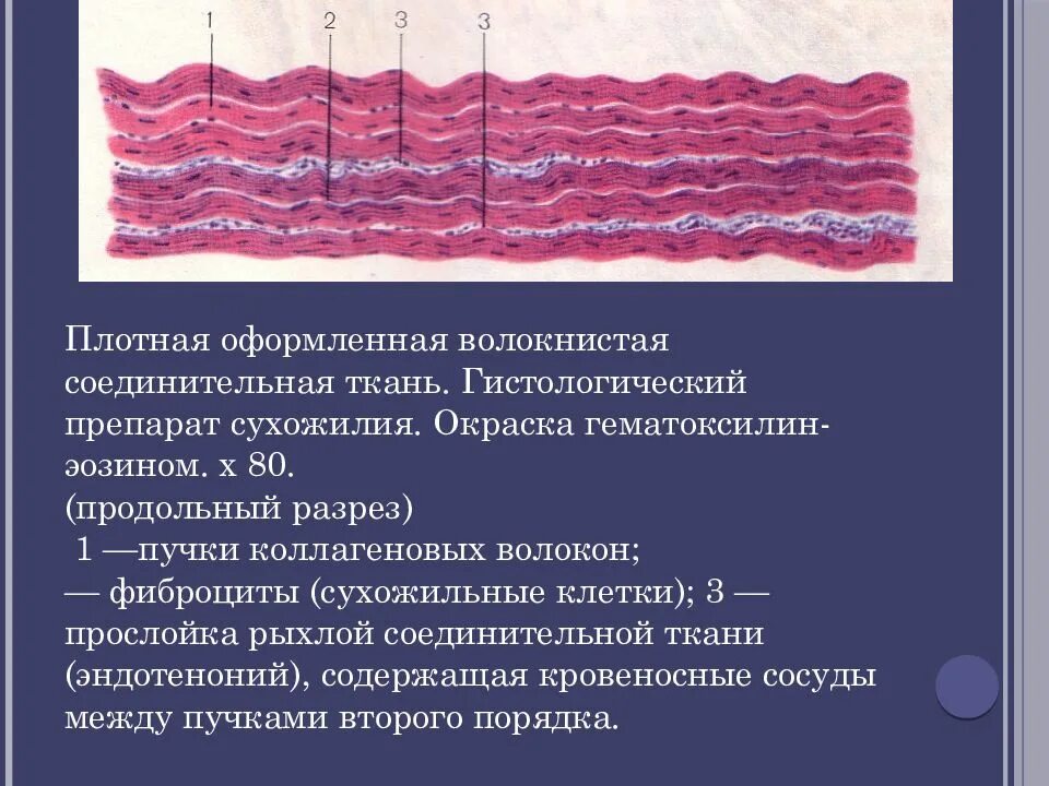 Плотная оформленная ткань. Плотная волокнистая ткань сухожилие. Плотная волокнистая соединительная ткань гистология. Плотная оформленная соединительная ткань препарат поперечный срез. Плотная оформленная соединительная ткань коллагеновые волокна.