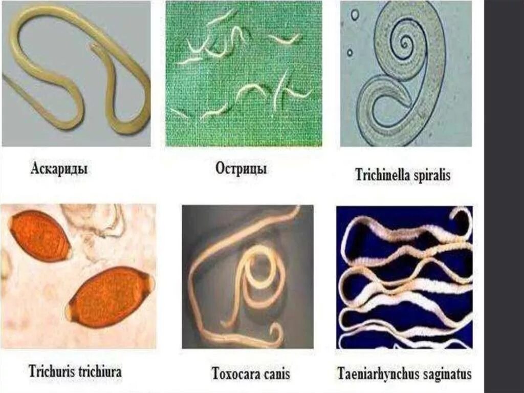 Гельминтоз энтеробиоз аскаридоз. Глисты аскариды острицы. Энтеробиоз аскаридоз трихинеллез. Аскаридоз энтеробиоз трихоцефалез.