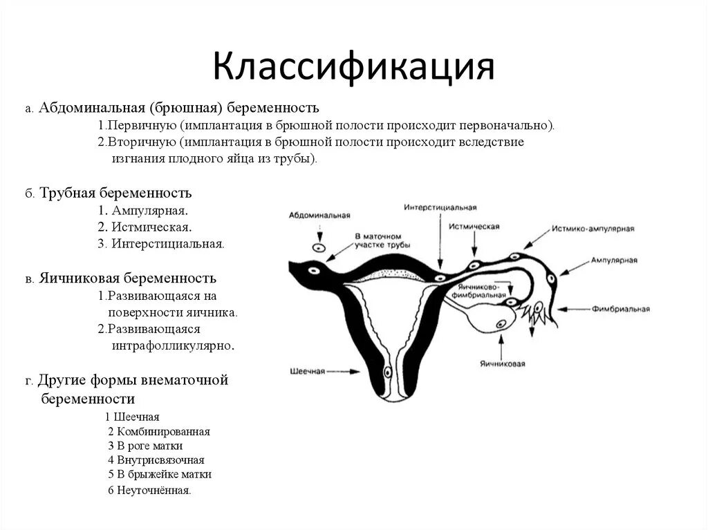 Можно ли забеременеть без маточных