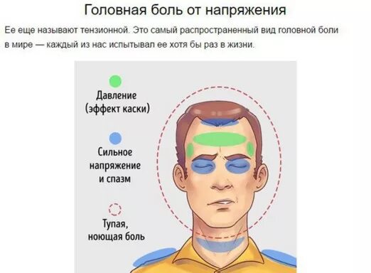 Болит голова с одной стороны и глаз. Болит голова. Типы головной боли. Головная боль локализация. Головная боль напряжения причины.