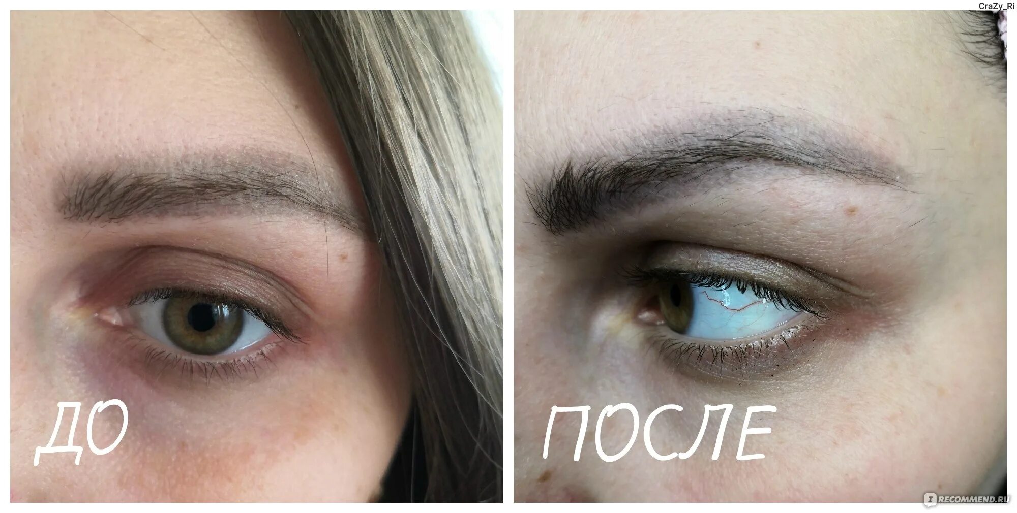 Сыворотка топлэш для ресниц. Сыворотка для роста ресниц и бровей TOPLASH Cosmetics Lash and Brow Booster. Отрастить брови с никотиновой кислотой до после.