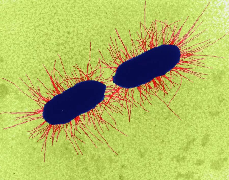 Эукариоты кишечная палочка. Escherichia coli под микроскопом. Бактерия Escherichia coli под микроскопом. Escherichia coli микроскопия. Эшерихии жгутики.