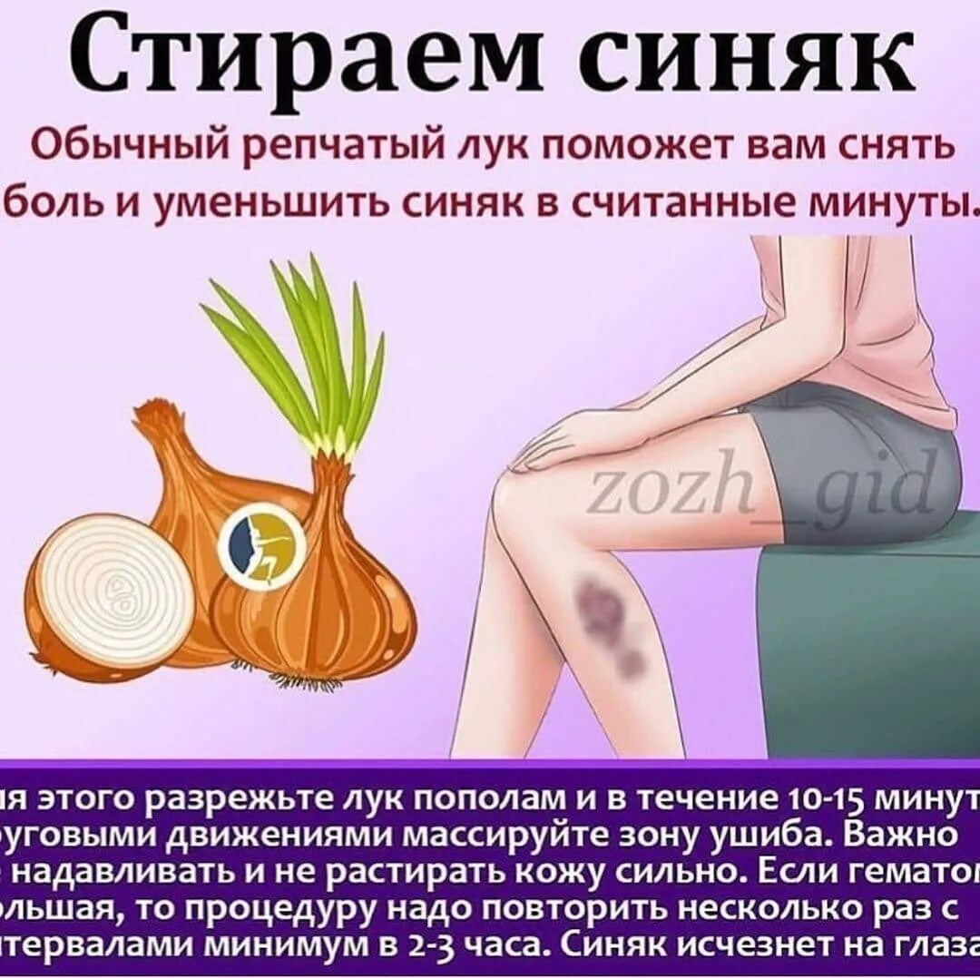Чем за день убрать синяк. Чем за день убрать синяк. Чем за день убрать синяк. Народные средства от синяка. Как быстро убрать кровоподтеки.