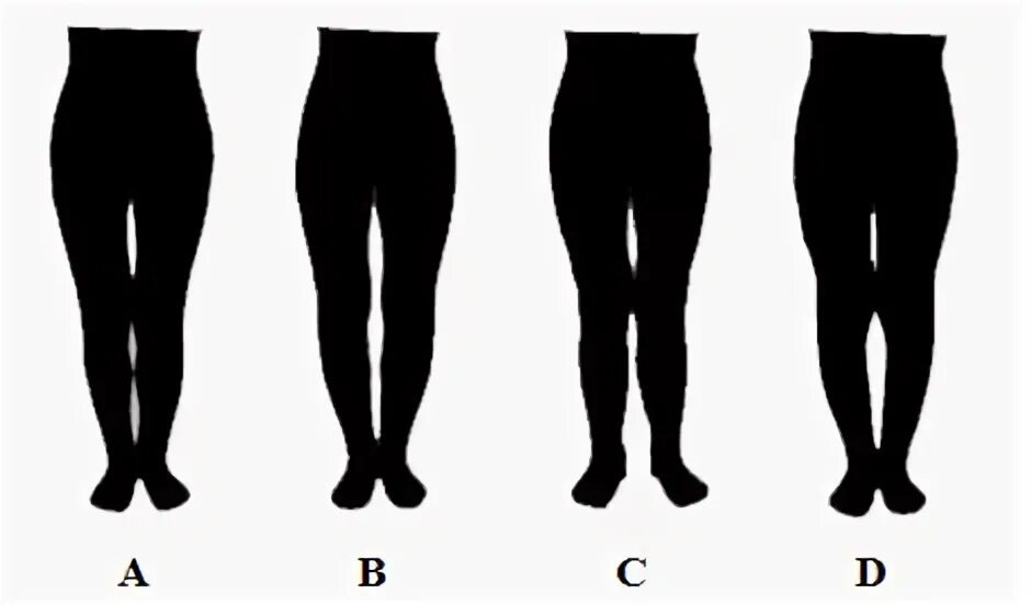 Прямо насколько. Формы женских ног. Идеальная форма ног. Форма ног у женщин. Правильная форма женских ног.