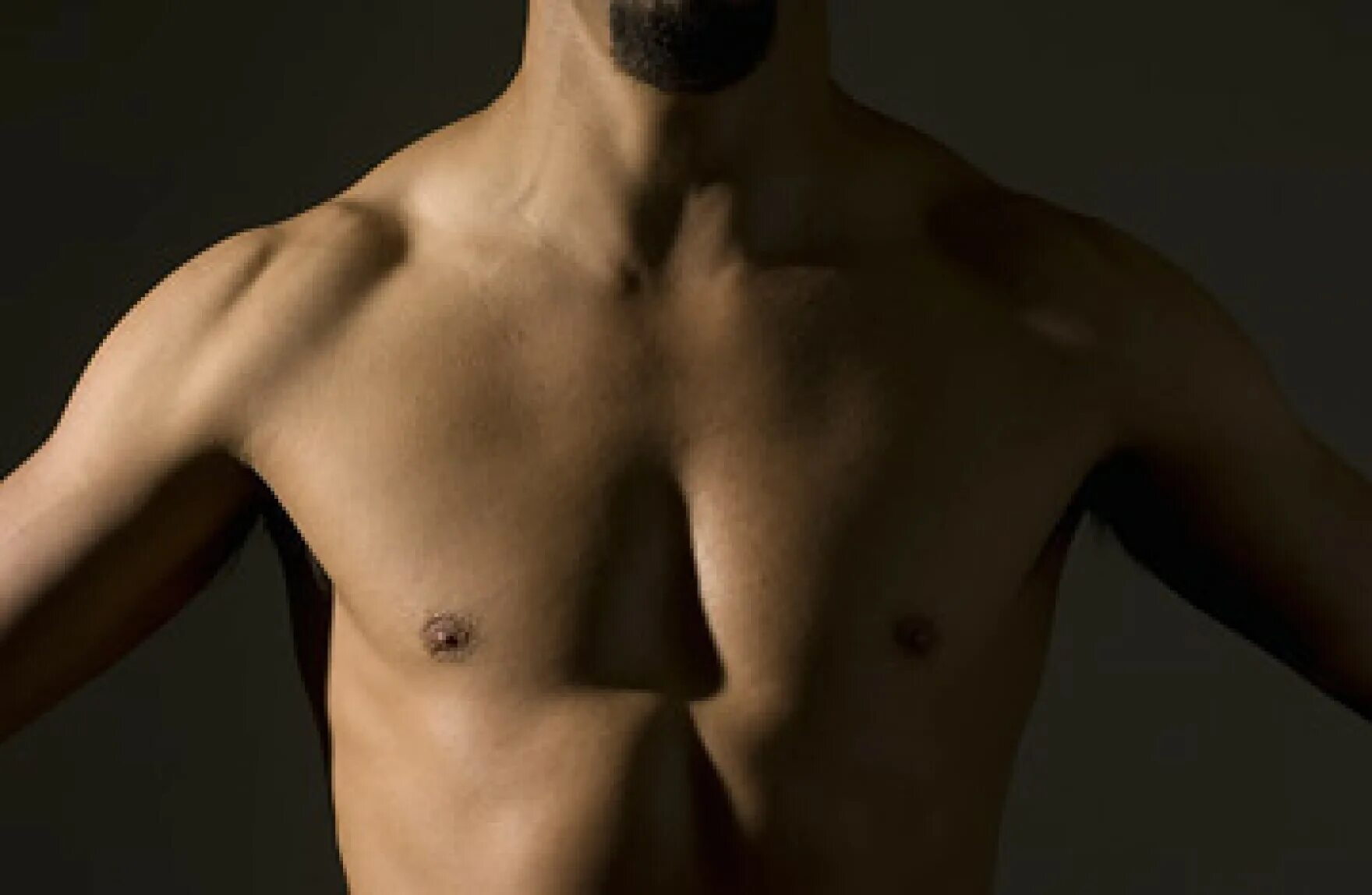 Молочной железы у мужчин симптомы. Мужская грудь. Мужская грудная клетка.