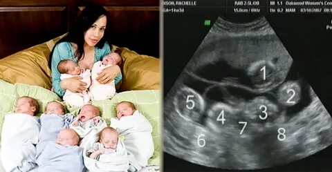 Сколько детей может родить женщина за жизнь