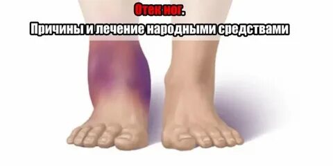 Лечение почему не стоит