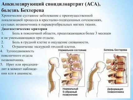 Отек на спине